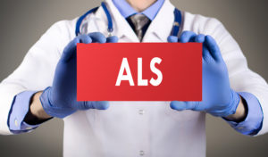 Caregiver Huntington Beach CA: Effective ALS Caregiver Tips